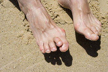 Is Hammertoe Hereditary? : Arizona Foot and Ankle Medical Center:  Podiatrists